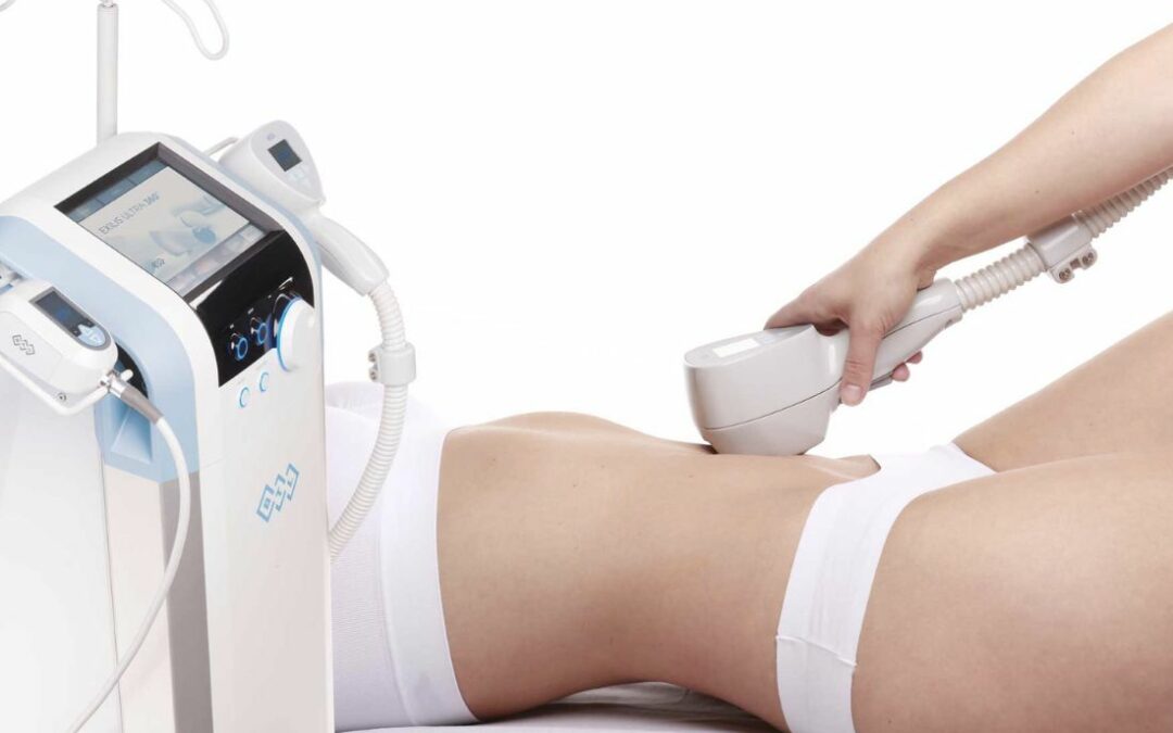 EXILIS ULTRA 360® : la radiofréquence redessine votre corps